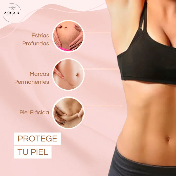 CREMA ANTIESTRÍAS SKINREPAIR