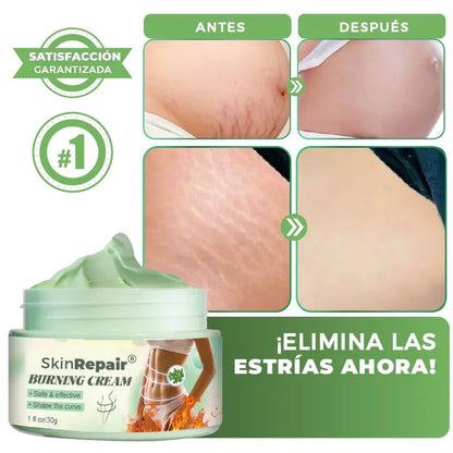 CREMA ANTIESTRÍAS SKINREPAIR